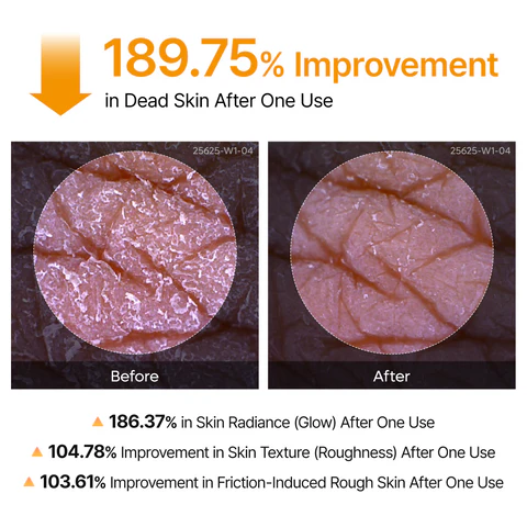 Dr.Melaxin Body Keratin CareKojic Acid Turmeric Spray withAHA & PHA, Gentle BodyBrightening & ExfoliatingPeeling Solution for Dead SkinCells & Texture, KoreanSkincare,6.76 fl.o
