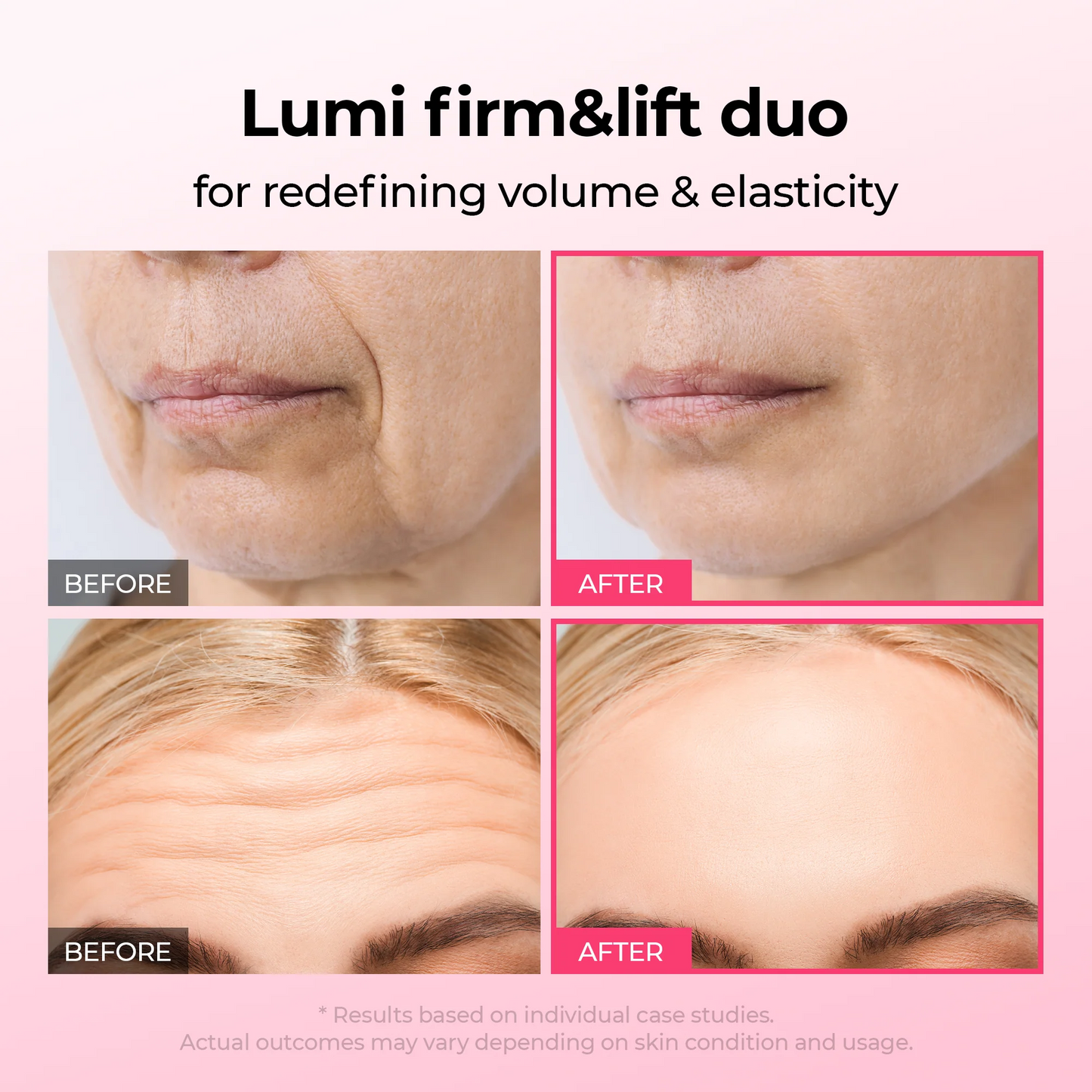 Dr.Melaxin Lumi firm & lift Duo IKorean facial Collagen Firmingserum plumping skin &tightening refines skin repairdensity I Cyano Pink SpiculeSerum + Picotonic ShotAmpoule